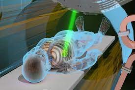 radiationtherapy